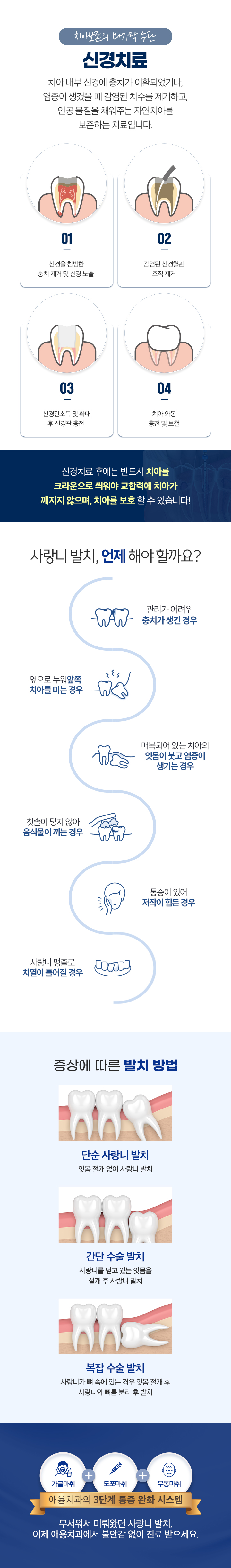 신경치료