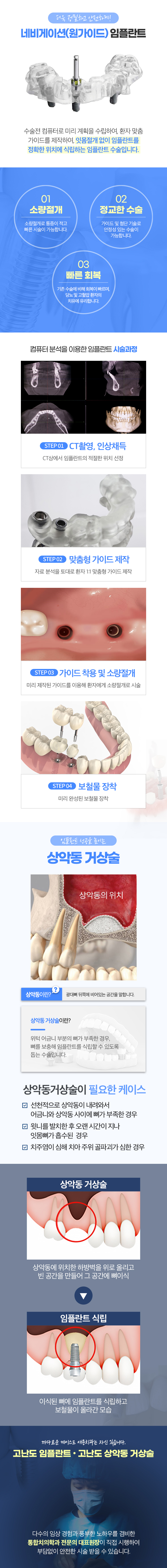 임플란트_02