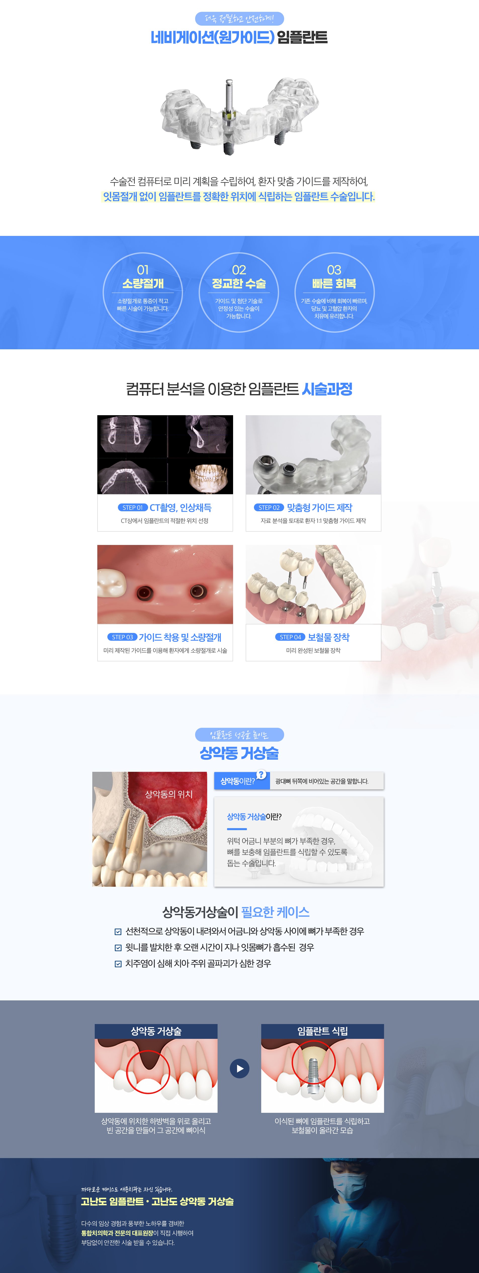 임플란트_02